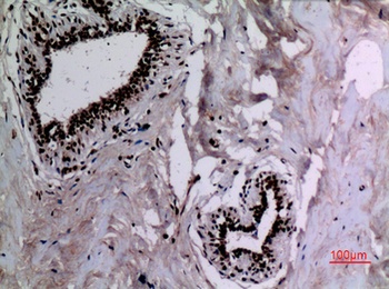 HSP 90 (Acetyl Lys292/284) rabbit pAb Antibody