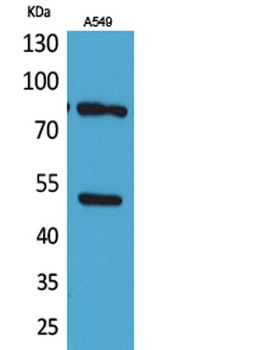 HSP 90 (Acetyl Lys435) rabbit pAb Antibody