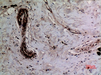 Ku-70 (Acetyl Lys542) rabbit pAb Antibody
