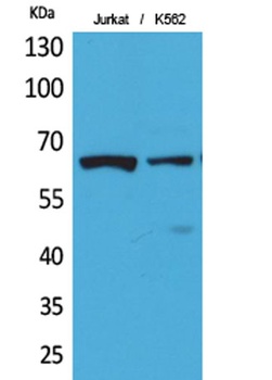 NFκB-p65 (Acetyl Lys218) rabbit pAb Antibody