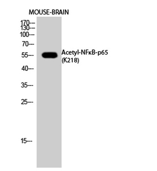 NFκB-p65 (Acetyl Lys218) rabbit pAb Antibody