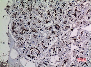NFκB-p65 (Acetyl Lys218) rabbit pAb Antibody