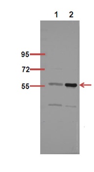 NFκB-p65 (Acetyl Lys218) rabbit pAb Antibody