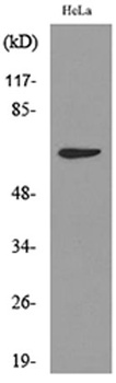 Cytokeratin-pan (Acetyl Lys194) rabbit pAb Antibody