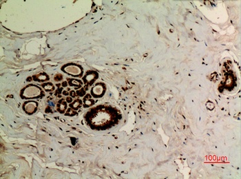 Ub (Acetyl Lys27) rabbit pAb Antibody