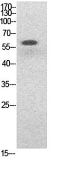 NFκB-p65 (Acetyl Lys314/Lys315) rabbit pAb Antibody