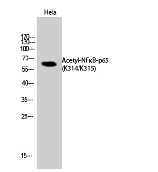 NFκB-p65 (Acetyl Lys314/Lys315) rabbit pAb Antibody