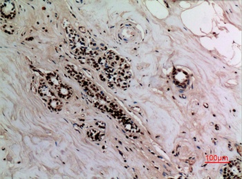 NFκB-p65 (Acetyl Lys314/Lys315) rabbit pAb Antibody