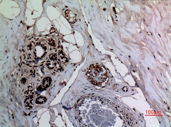 NFκB-p65 (Acetyl Lys314/Lys315) rabbit pAb Antibody