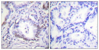 C/EBP β (phospho Thr235) rabbit pAb Antibody