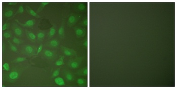 C/EBP β (phospho Thr235) rabbit pAb Antibody