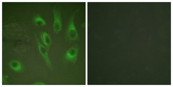 Calnexin (phospho Ser583) rabbit pAb Antibody