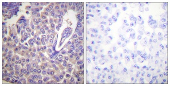 Calnexin (phospho Ser583) rabbit pAb Antibody