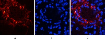 Catenin-β (phospho Ser37) rabbit pAb Antibody