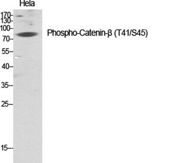 Catenin-β (phospho Thr41/S45) rabbit pAb Antibody