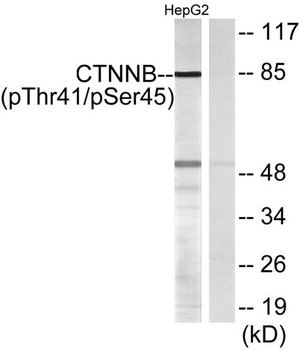Catenin-β (phospho Thr41/S45) rabbit pAb Antibody