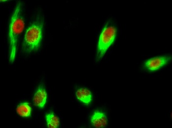 Chk2 (phospho Thr68) rabbit pAb Antibody