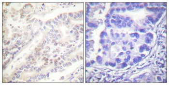 Cyclin B1 (phospho Ser126) rabbit pAb Antibody