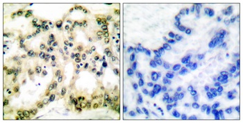 Cyclin B1 (phospho Ser126) rabbit pAb Antibody