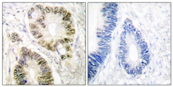 Cyclin E1 (phospho Thr395) rabbit pAb Antibody