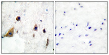 DARPP-32 (phospho Thr75) rabbit pAb Antibody