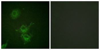 EGFR (phospho Thr693) rabbit pAb Antibody