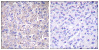 EGFR (phospho Thr693) rabbit pAb Antibody