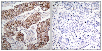 EGFR (phospho Tyr1092) rabbit pAb Antibody