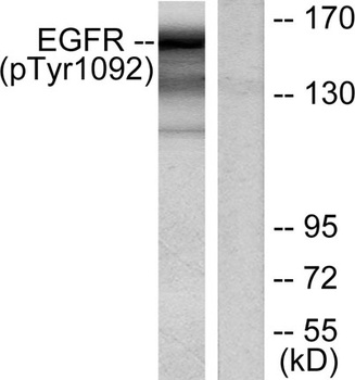 EGFR (phospho Tyr1092) rabbit pAb Antibody