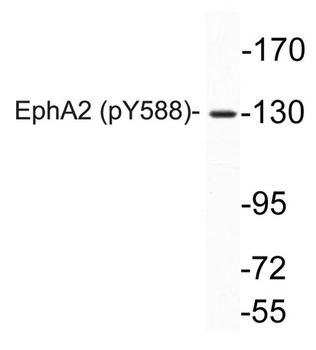EphA2 (phospho Tyr588) rabbit pAb Antibody