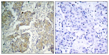 Flk-1/VEGFR2 (phospho Tyr1214) rabbit pAb Antibody