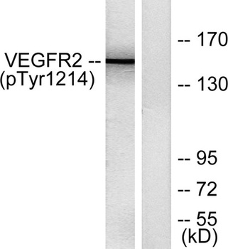 Flk-1/VEGFR2 (phospho Tyr1214) rabbit pAb Antibody