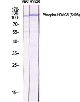 HDAC5 (phospho Ser498) rabbit pAb Antibody
