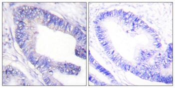 IRS-1 (phospho Ser1101) rabbit pAb Antibody