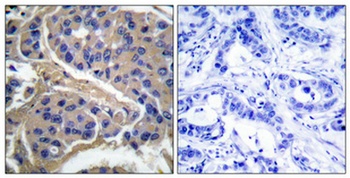 IRS-1 (phospho Ser307) rabbit pAb Antibody
