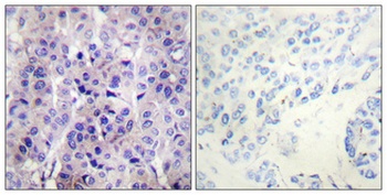 IRS-1 (phospho Ser307) rabbit pAb Antibody
