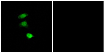 IRS-1 (phospho Ser307) rabbit pAb Antibody