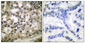 IκB-β (phospho Ser23) rabbit pAb Antibody