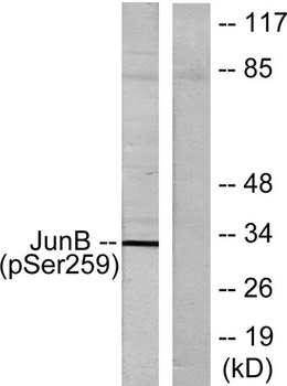 Jun B (phospho Ser259) rabbit pAb Antibody
