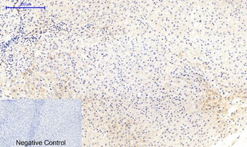 MEK-1/2 (phospho Ser218/222) rabbit pAb Antibody
