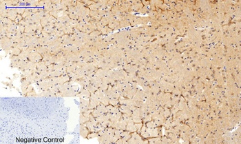 MEK-1/2 (phospho Ser218/222) rabbit pAb Antibody