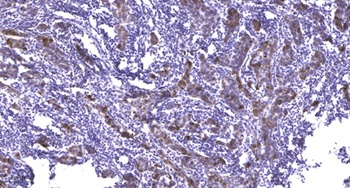 Met (phospho Tyr1234) rabbit pAb Antibody