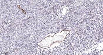 Met (phospho Tyr1349) rabbit pAb Antibody