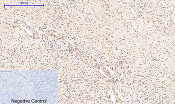 NFκB-p65 (phospho Ser276) rabbit pAb Antibody
