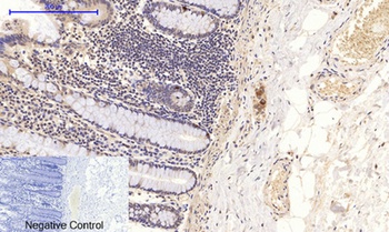NFκB-p65 (phospho Ser276) rabbit pAb Antibody