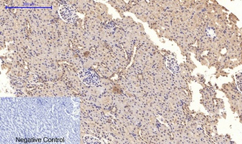 NFκB-p65 (phospho Ser276) rabbit pAb Antibody