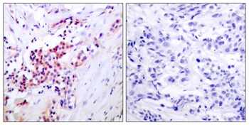 NFκB-p65 (phospho Ser468) rabbit pAb Antibody