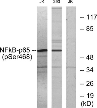 NFκB-p65 (phospho Ser468) rabbit pAb Antibody