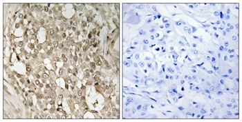 NFκB-p65 (phospho Ser529) rabbit pAb Antibody