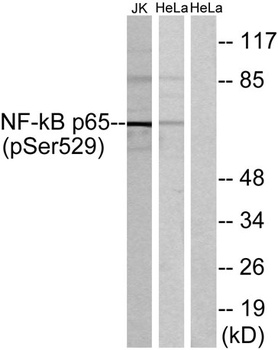 NFκB-p65 (phospho Ser529) rabbit pAb Antibody
